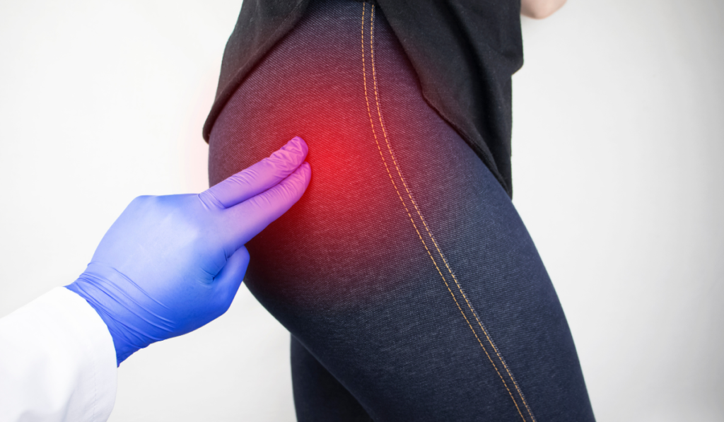 MIGLIORARE LE CURE PER LA SCIATICA